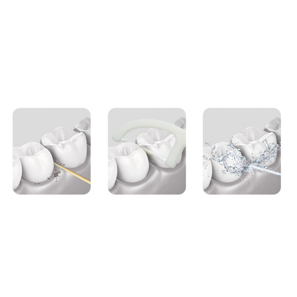 Portable Water Flosser